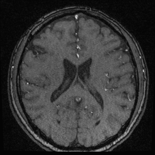 Click on the Serie image to view the images of VILLANUEVA, WILLIAM A.